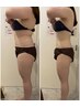 【30代からの本気痩身】落ちにくい脂肪を分解×代謝促進×徹底痩身90分¥4980