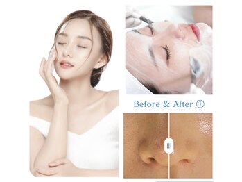 フリージア(Beauty Salon Freesia )/美肌菌活ピール