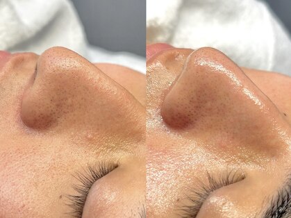 ミュー 徳川店(mieux)の写真