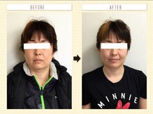 美容整体ウェリナ あま甚目寺院/小顔矯正/骨盤矯正/美脚サロン