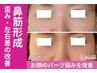 【歪み・左右差・鼻】定着が早い骨格パーツ矯正＋頭蓋骨矯正◇¥8,000