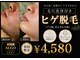 アルゴ 伊勢崎店(ALGO)の写真