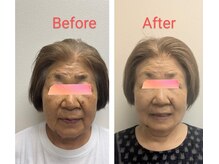 美 ウツクシ(美 U.tsu.ku.shi)/80代印象変化　最短最速の肌効果