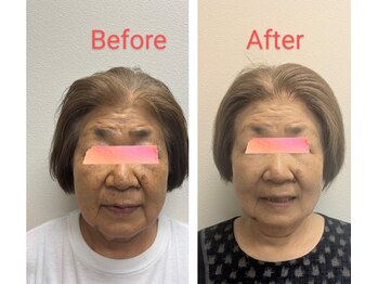 美 ウツクシ(美 U.tsu.ku.shi)/80代印象変化　最短最速の肌効果