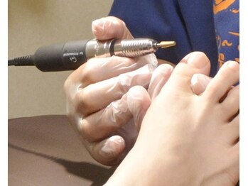 ドリーム メディカル ラボ(Dream Medical Labo)の写真/巻き爪のスペシャリストによる施術で長年の爪の悩みを解消！【カウンセリング込　巻き爪補正1回￥5400～】