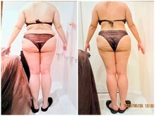 パーフェクトボディプレミアム 名古屋駅前店(PERFECT BODY PREMIUM)/お客様　ビフォーアフター（25）