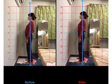 みふく整体院/姿勢のチェック