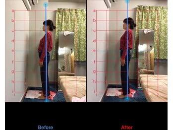 みふく整体院/姿勢のチェック