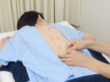 曙橋なかえ鍼灸治療院