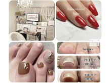 ネイラックス(Nailax)の雰囲気（巻き爪やフットケアも大好評！人気メニューの一つです♪）