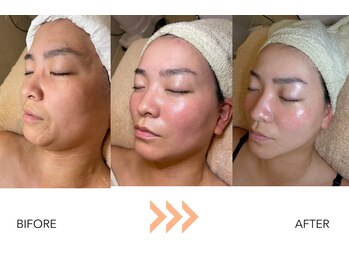 エングラッシー(en glassy)/BEFORE　AFTER　30代