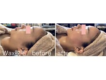 ソラ 六本松店(SORA)の雰囲気（美肌メニューも充実◎お顔Wax脱毛、HARIケアで健康的な肌作り）