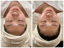 コア(Coeur)/【艶肌爆誕】befor→after