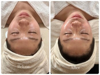 コア(Coeur)/【艶肌爆誕】befor→after