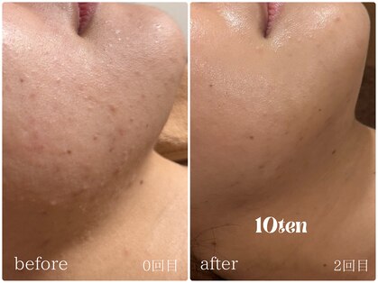 テン(10ten)の写真