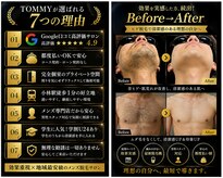 トミー(TOMMY)