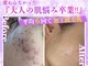 ノア 新宿(Noa)の写真