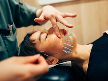 くすの樹接骨院 整体院 町田院/[美容鍼/鍼灸]リフトアップ/小顔