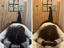 ナオル整体 札幌院(NAORU整体)/札幌円山/整体/姿勢矯正/猫背