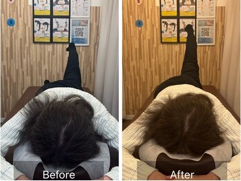 ナオル整体 札幌院(NAORU整体)/札幌円山/整体/姿勢矯正/猫背