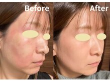サロン デ ミロ(Salon de Miro)/BeforeAfter多数！ブログへGO♪