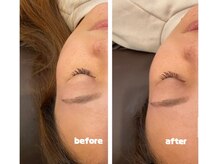 サロン ド ララ(Salon de LALA)の雰囲気（光フェイシャルはあらゆる肌悩みに万能♪一回の施術で小顔効果◎）