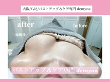 デミーナ(Demyna)/