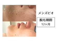 メンズビオ 神戸三宮店/