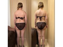 モモリラ(momorila)の雰囲気（新感覚！吸われてスッキリ♪活性リンパ洗浄◎お得なクーポンあり）