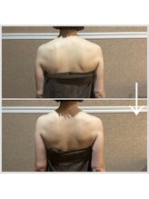 エステティックサロン ベルエトワール住吉店/身体のラインを整える