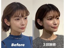 コルミチョン サロン(骨美整 salon)/Before・After(左右非対称施術)