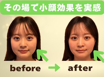 カラダリセット 上本町の写真