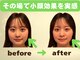 カラダリセット 上本町の写真