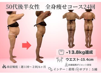 マキシア(MaxiA)/ぽっこりお腹も撃退