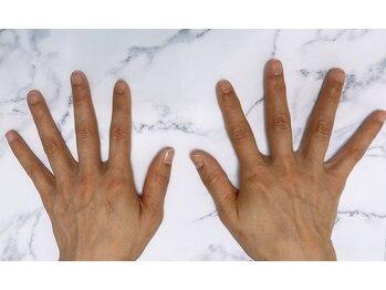 リフレンズ(Reフレンズ)/ネイルケア