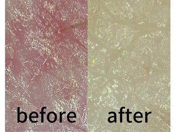 タリア(TALIA)/マイクロスコープでより鮮明に♪