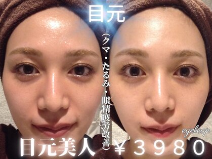 アイリープ(eyeleap)の写真