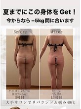 フローラ 自由が丘(Flora)/痩せて自信を持とう