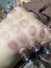 疲労回復コリリセット集中トリートメント！