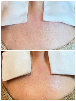 アトレ(Atre)/おでこもつるつや♪