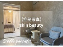 ベル 大和(Belle)/ハーブピーリング｜写真