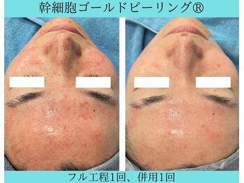 リメイククリニカルビューティー(Remake clinical beauty)/