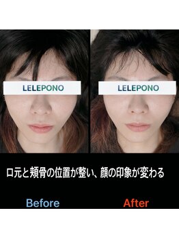 美容矯正サロン レレポノ(LELEPONO)/