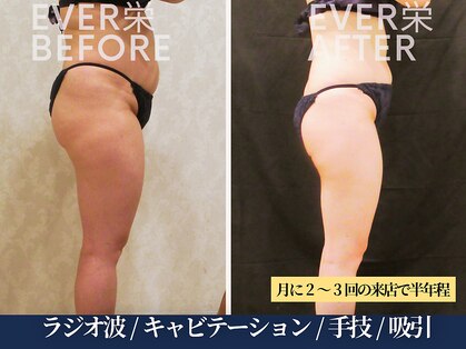エヴァーグレース 北千住店の写真