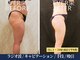 エヴァーグレース 北千住店の写真