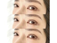 エラ(Era)/まつ毛と眉毛のセットメニュー