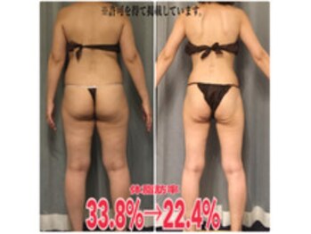 ボディエステティック アクアオーラ 富山店/モデルさん級のスタイル!