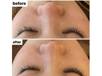 メナードフェイシャルサロン 岐阜茜部/クリーンパック