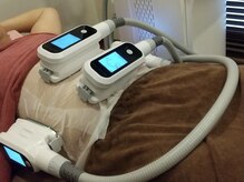 ユー(U)/脂肪冷却　4CUP　お腹