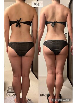 リープ(Lieb)/ブライダル/ビフォーアフター